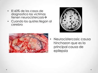 • El 60% de los casos de
  diagnostico las victimas
  tienen neurocistercosis
• Cuando los quistes llegan al
  cerebro



                            • Neurocistercosis: causa
                              hinchazon que es la
                              principal causa de
                              epilepsia
 