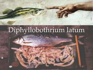 Diphyllobothrium latum
 