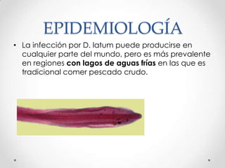 EPIDEMIOLOGÍA
• La infección por D. latum puede producirse en
  cualquier parte del mundo, pero es más prevalente
  en regiones con lagos de aguas frías en las que es
  tradicional comer pescado crudo.
 
