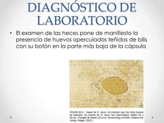 DIAGNÓSTICO DE
       LABORATORIO
• El examen de las heces pone de manifiesto la
  presencia de huevos operculados teñidos de bilis
  con su botón en la parte más baja de la cápsula
 