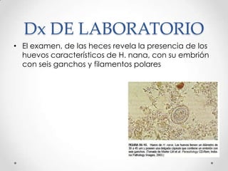 Dx DE LABORATORIO
• El examen, de las heces revela la presencia de los
  huevos característicos de H. nana, con su embrión
  con seis ganchos y filamentos polares
 