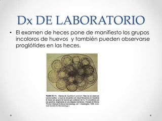 Dx DE LABORATORIO
• El examen de heces pone de manifiesto los grupos
  incoloros de huevos y también pueden observarse
  proglótides en las heces.
 