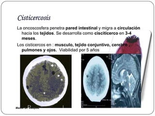 Cisticercosis
 La oncoscosfera penetra pared intestinal y migra a circulación
   hacia los tejidos. Se desarrolla como cisciticerco en 3-4
   meses.
 Los cisticercos en : musculo, tejido conjuntivo, cerebro ,
   pulmones y ojos. Viabilidad por 5 años




Master Dr. Vàsquez
 