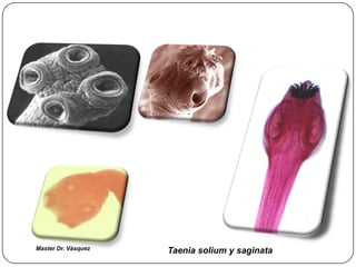 Master Dr. Vàsquez   Taenia solium y saginata
 
