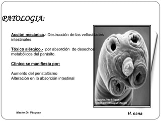 PATOLOGIA:
  Acción mecánica.- Destrucción de las vellosidades
  intestinales

  Tóxico alérgico.- por absorción de desechos
  metabólicos del parásito.

  Clinico se manifiesta por:

  Aumento del peristaltismo
  Alteración en la absorción intestinal




    Master Dr. Vàsquez                                H. nana
 