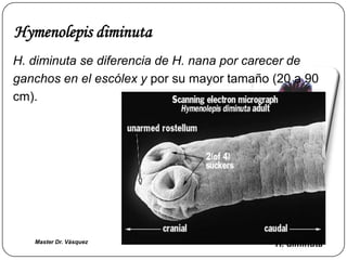 Hymenolepis diminuta
H. diminuta se diferencia de H. nana por carecer de
ganchos en el escólex y por su mayor tamaño (20 a 90
cm).




   Master Dr. Vàsquez                       H. diminuta
 