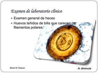 Examen de laboratorio clínico
  Examen general de heces
  Huevos teñidos de bilis que carecen de
    filamentos polares.




Master Dr. Vàsquez                          H. diminuta
 