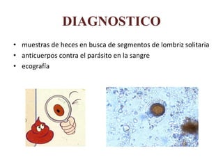 DIAGNOSTICO
• muestras de heces en busca de segmentos de lombriz solitaria
• anticuerpos contra el parásito en la sangre
• ecografía
 
