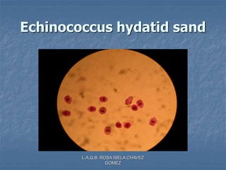 L.A.Q.B. ROSA ISELA CHAVEZ
GOMEZ
Echinococcus hydatid sand
 