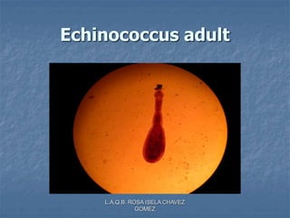 L.A.Q.B. ROSA ISELA CHAVEZ
GOMEZ
Echinococcus adult
 