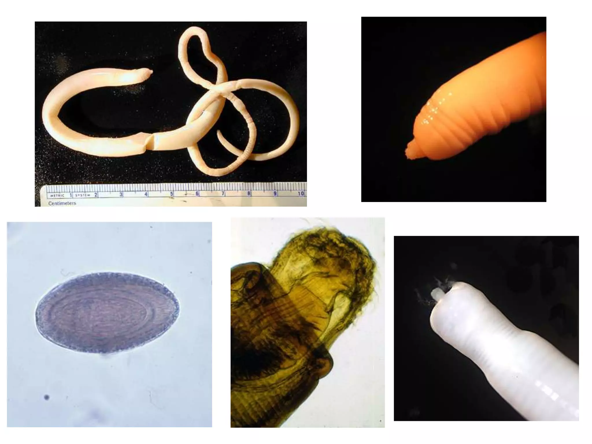  Observación post-mortem de diferentes sitios del animal (maseteros, intercostales, diafragma, corazón).
