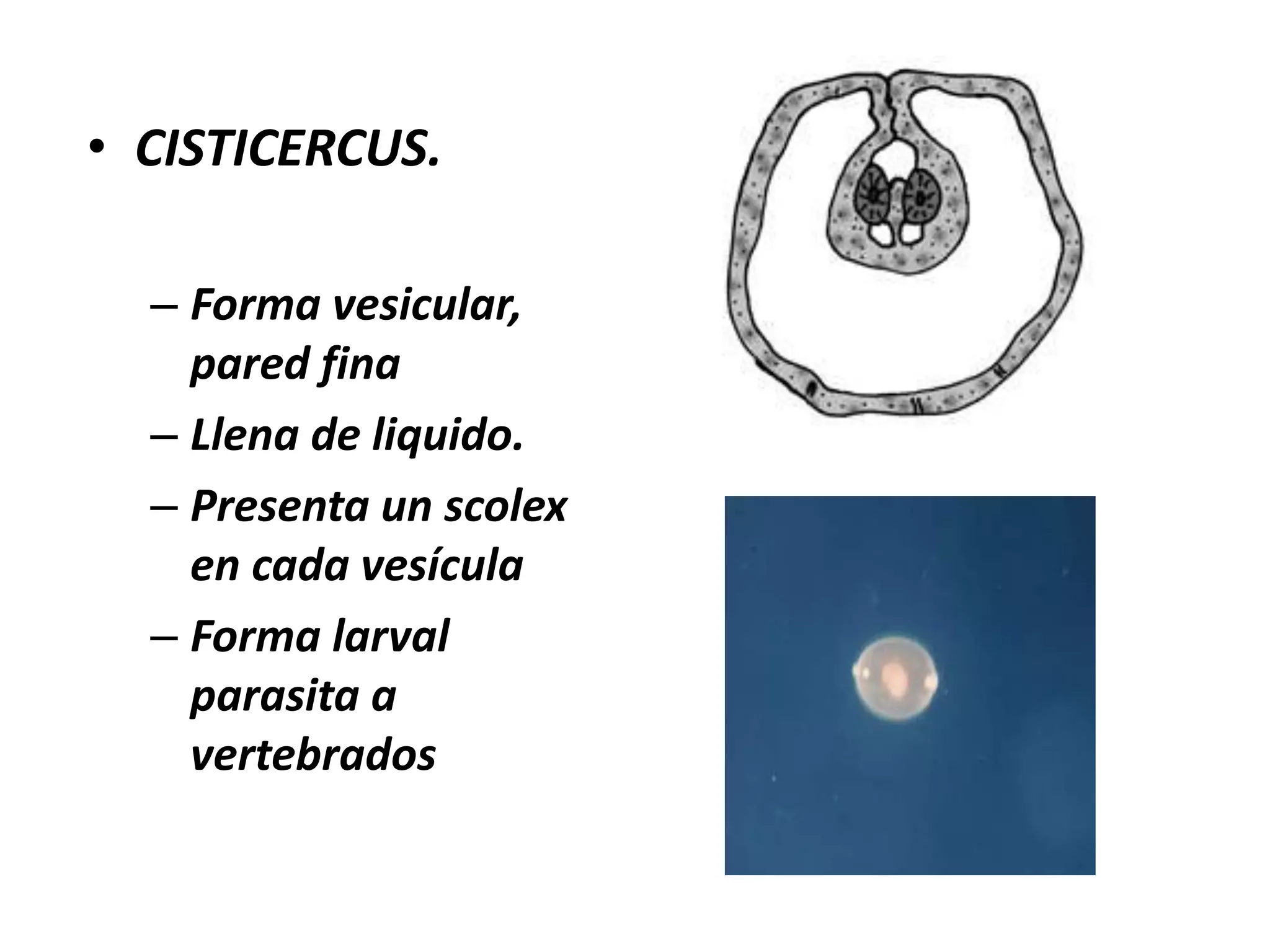 LARVAS DE CESTODOSCISTICERCOIDESCISTICERCUSCOENURUSQUISTE HIDATICO