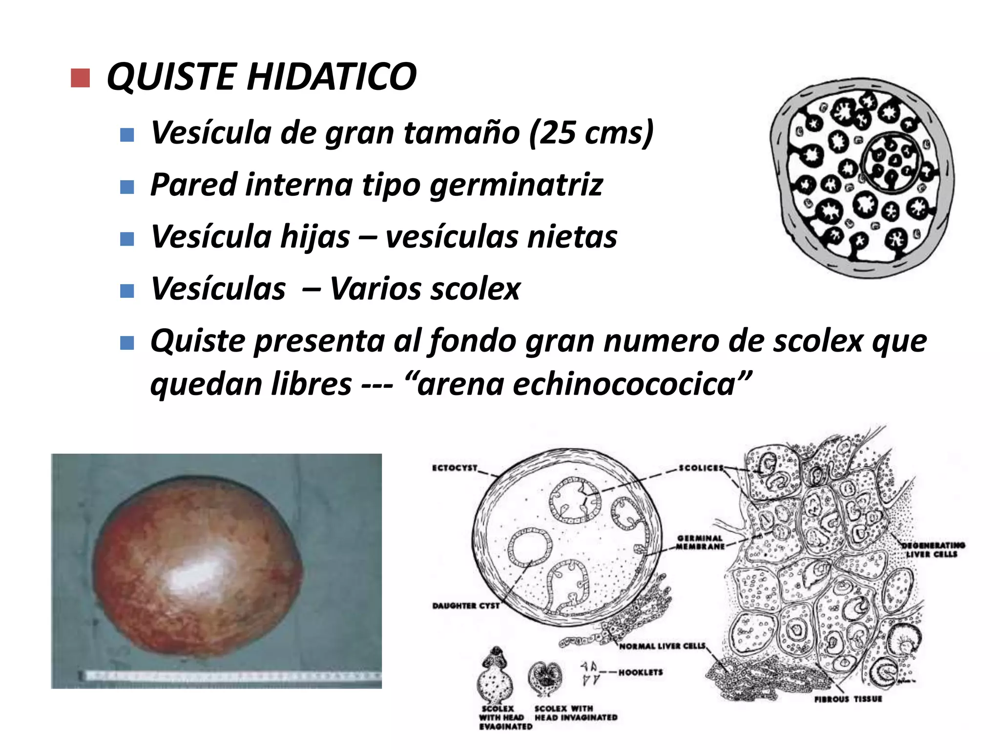 CISTICERCUS.Forma vesicular, pared finaLlena de liquido.Presenta un scolex en cada vesículaForma larval parasita a vertebrados