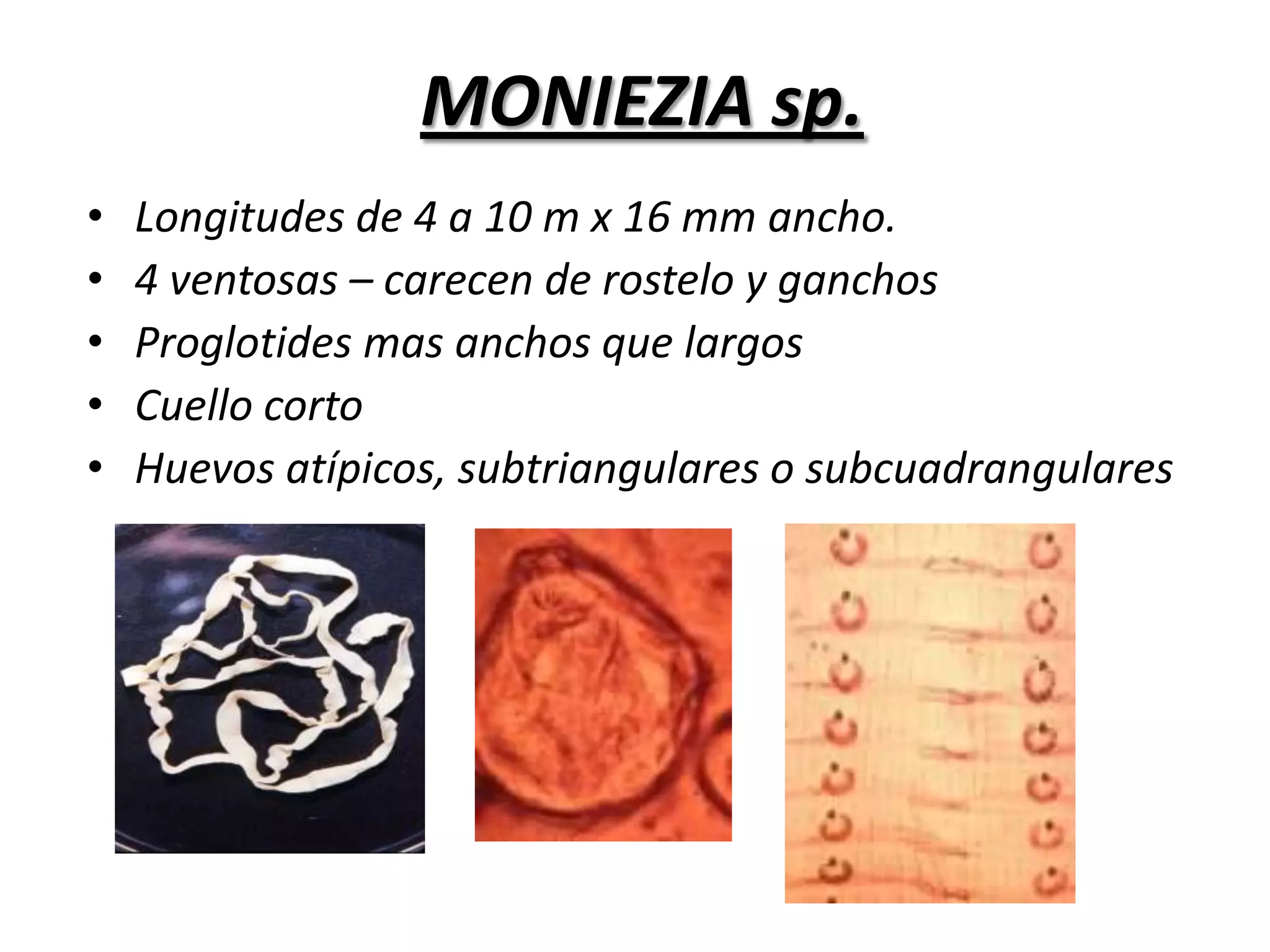 Vesícula de gran tamaño (25 cms)