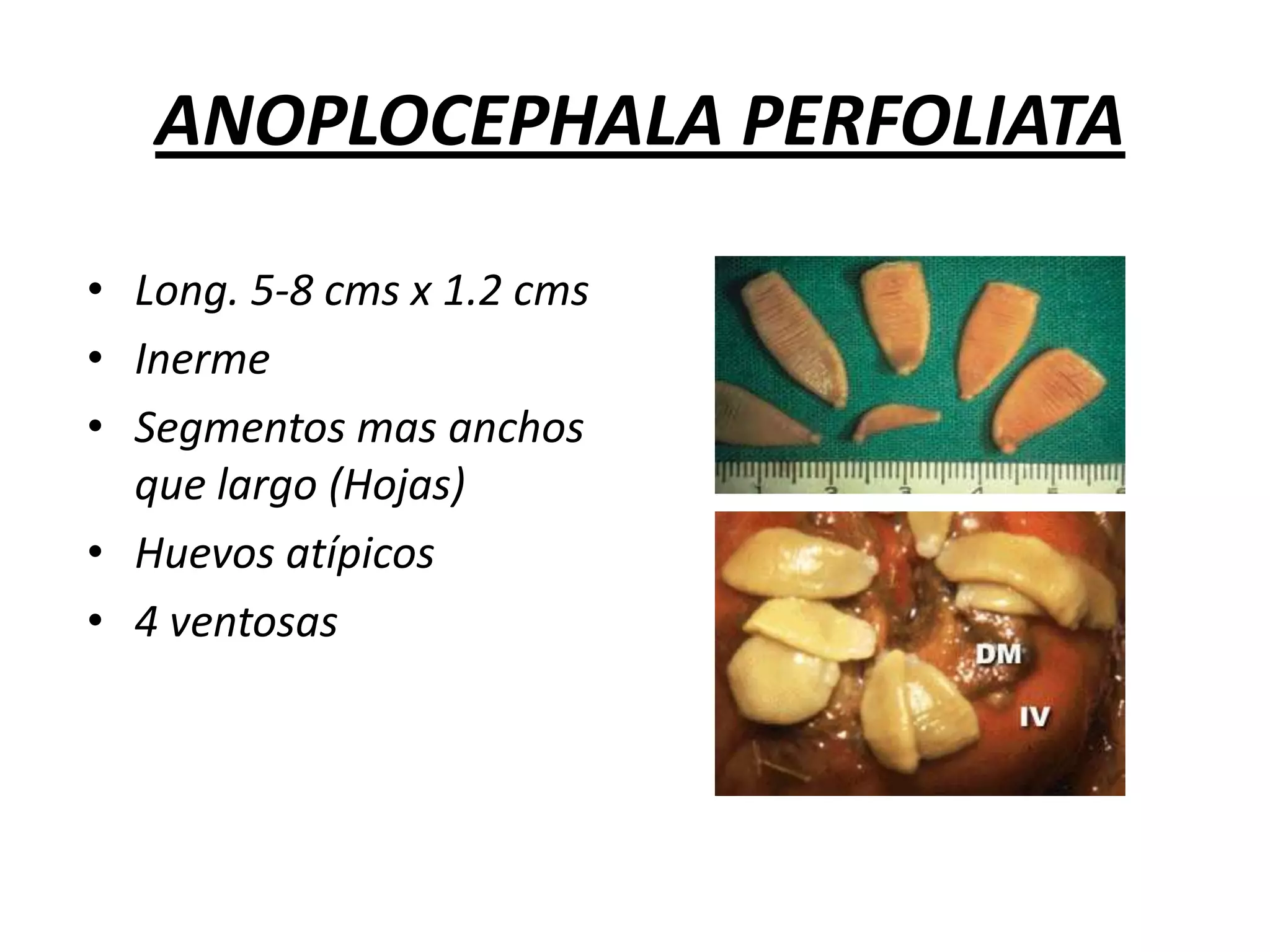 Quiste presenta al fondo gran numero de scolex que quedan libres --- “arena echinocococica”TAXONOMIA DE CESTODOSREINO		: ANIMALSUBREINO	: METAZOARIORAMA		: PLATYHELMINTHESCLASE		: CESTODAORDEN		:CYCLOPHYLLOIDEA		 PSEUDOPHYLLOIDEA