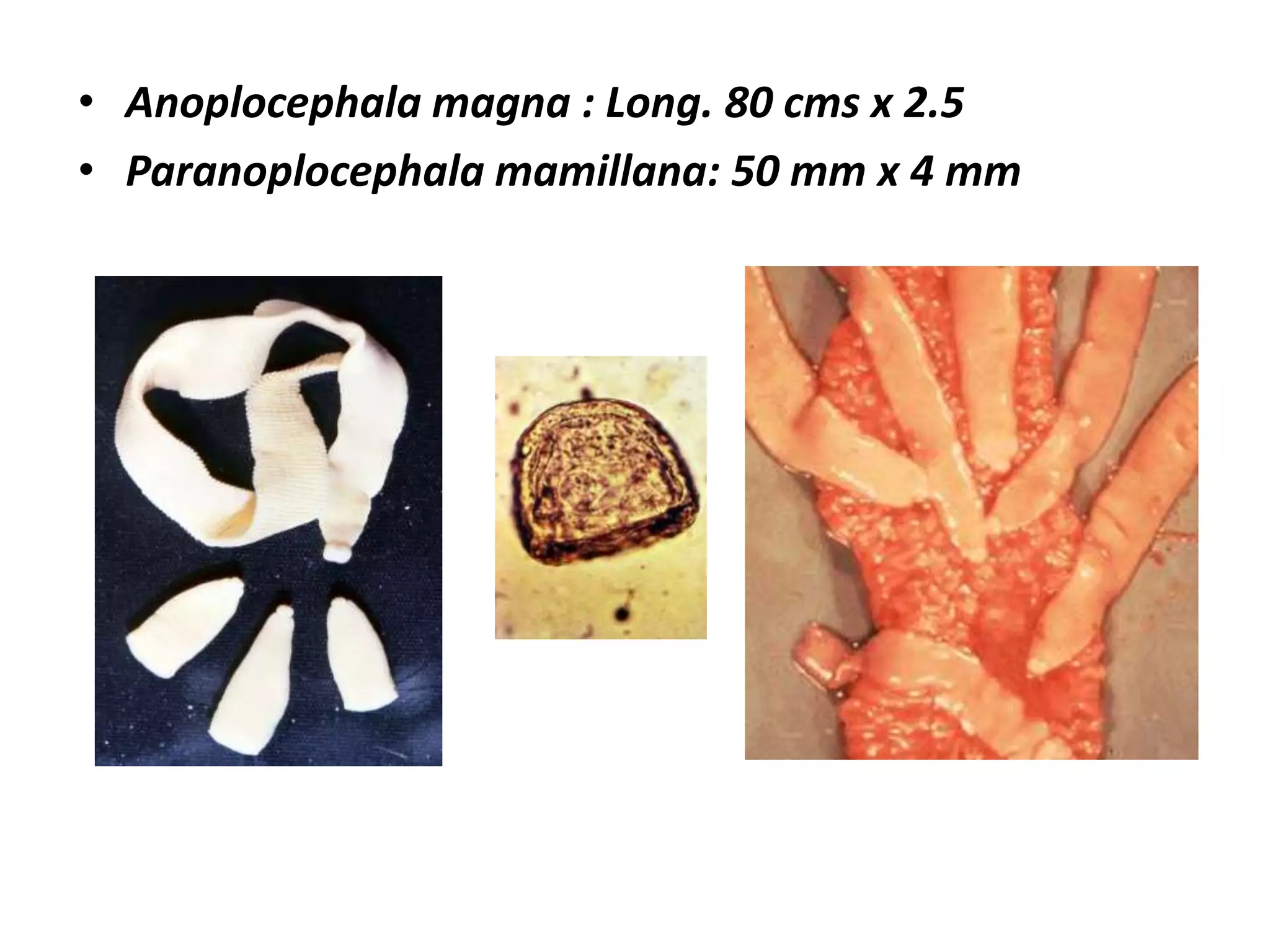 ORDEN		: CYCLOPHILLOIDEAFAMILIA		: AnoplocephalidaeFAMILIA		: TaeniidaeFAMILIA		: DipylidiidaeFAMILIA		: DavaineidaeFAMILIA		: HymenolepidiidaeORDEN		: PSEUDOPHYLLOIDEAFAMILIA		: Diphyllobothriidae