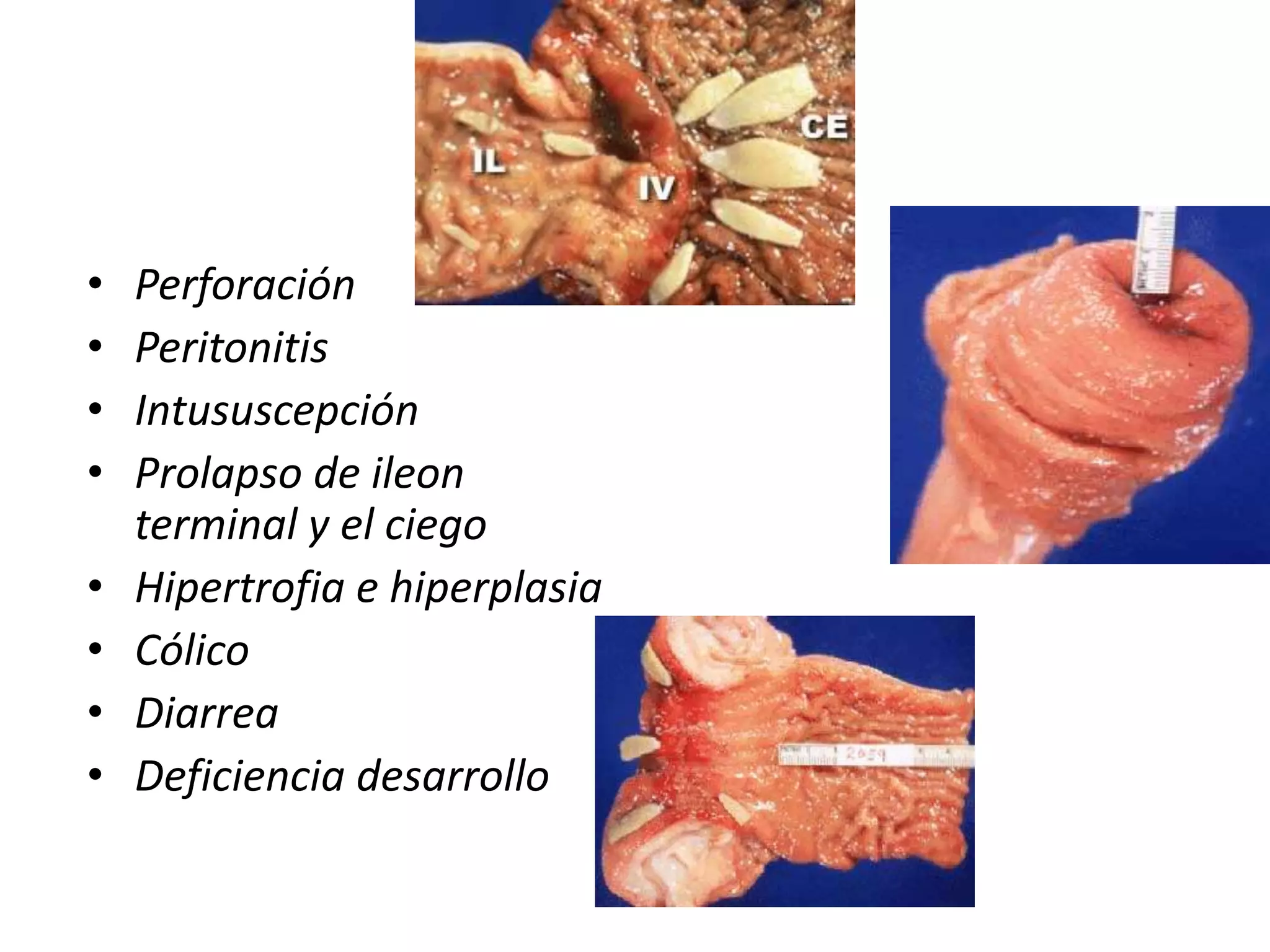 MONIEZIA sp.Longitudes de 4 a 10 m x 16 mm ancho.4 ventosas – carecen de rostelo y ganchos Proglotides mas anchos que largosCuello cortoHuevos atípicos, subtriangulares o subcuadrangulares