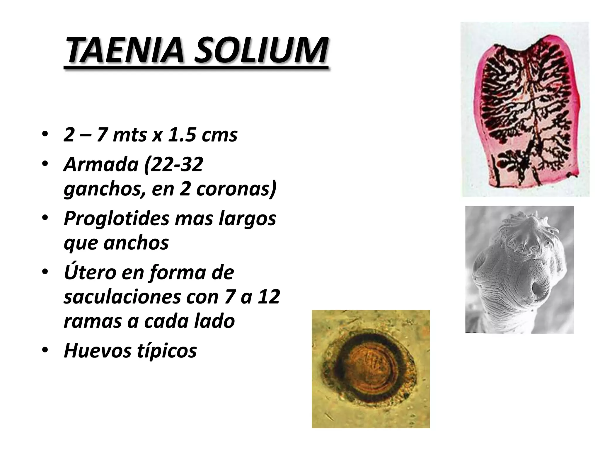 Choanotaenia infundibulumLong. 2.5 cms x 1 – 5 mm 