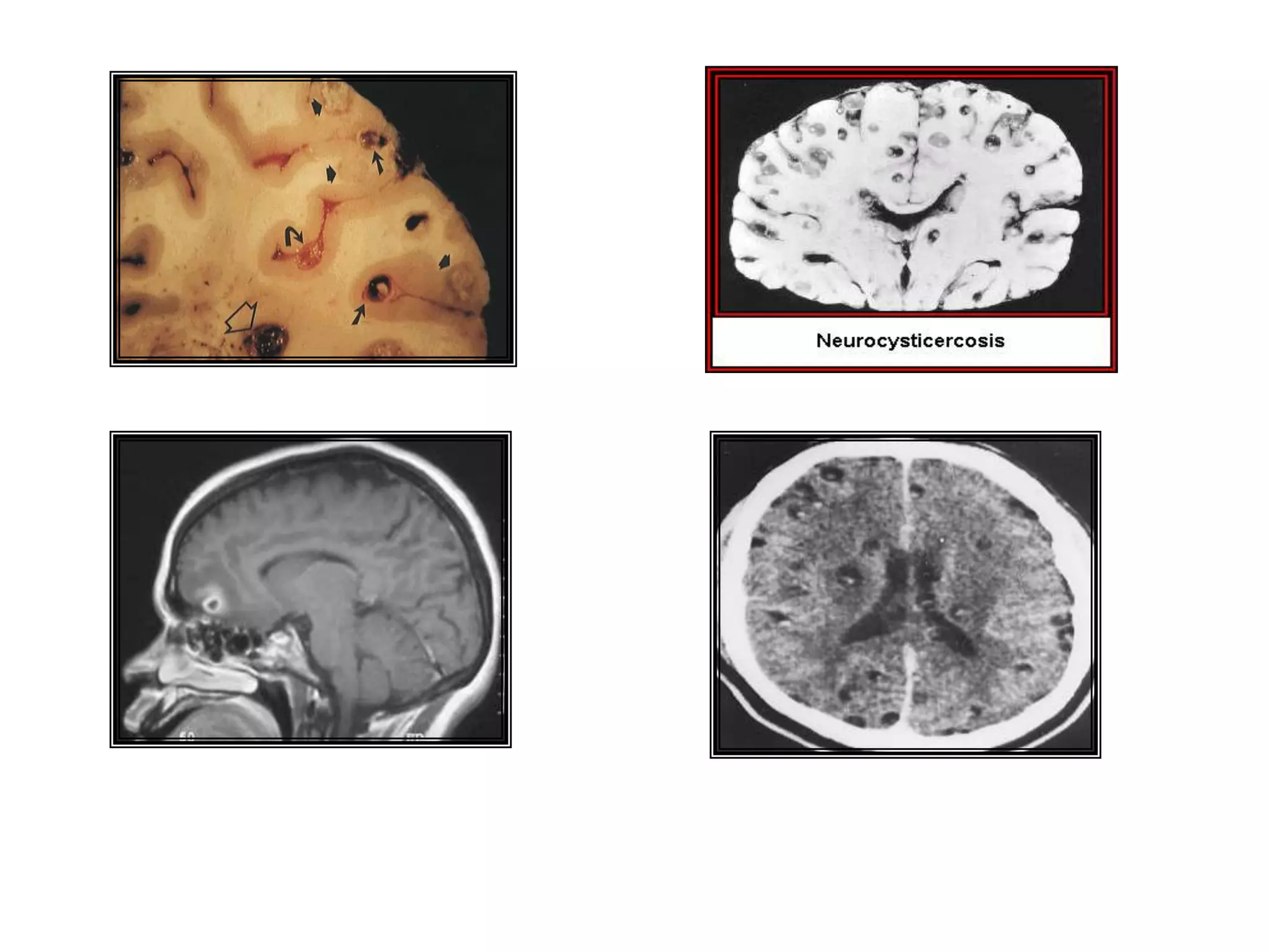  Falta de disposición adecuada de aguas servidas y basura.