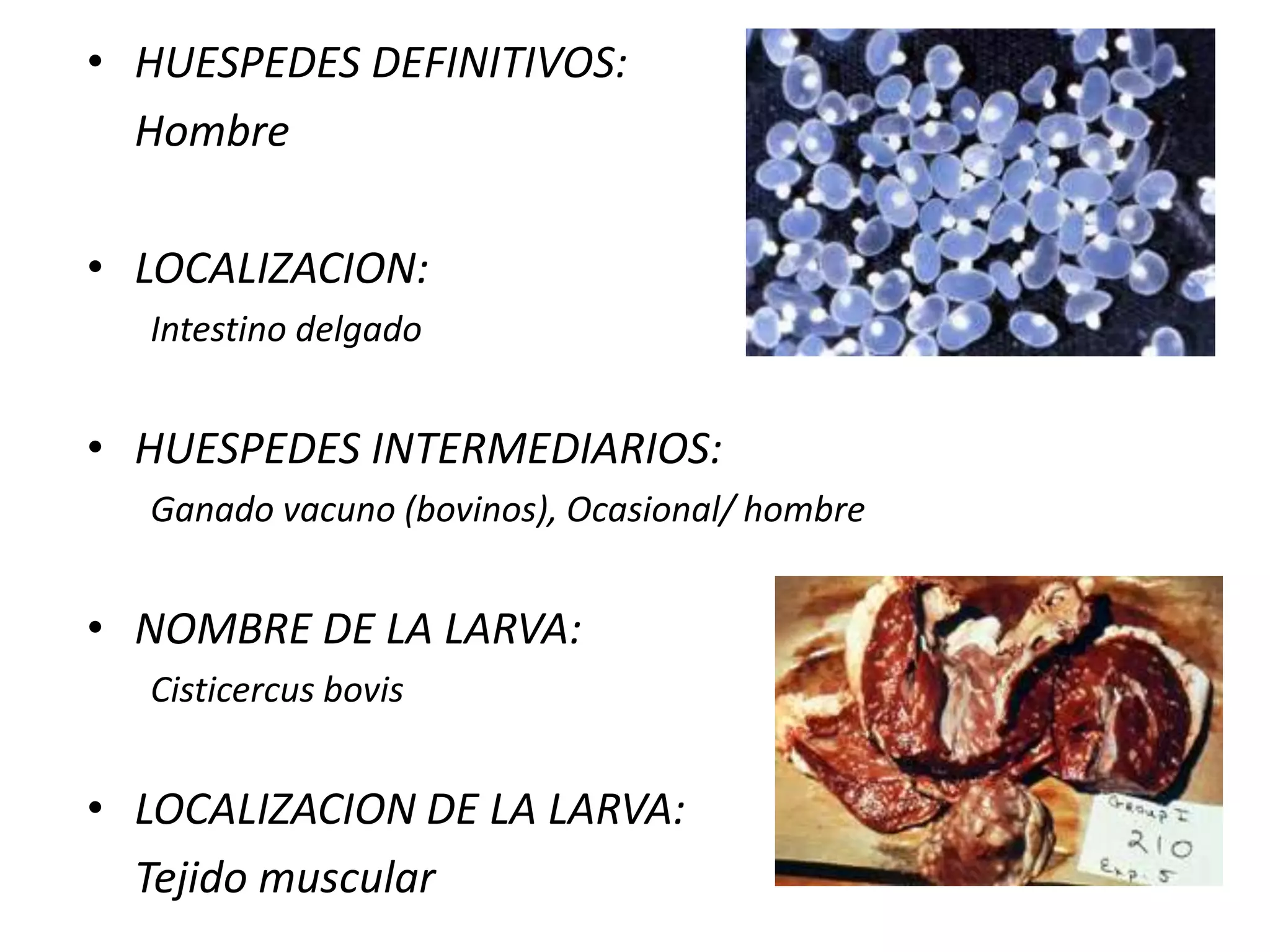  Ingestión de carne de cerdo insuficientemente cocida.