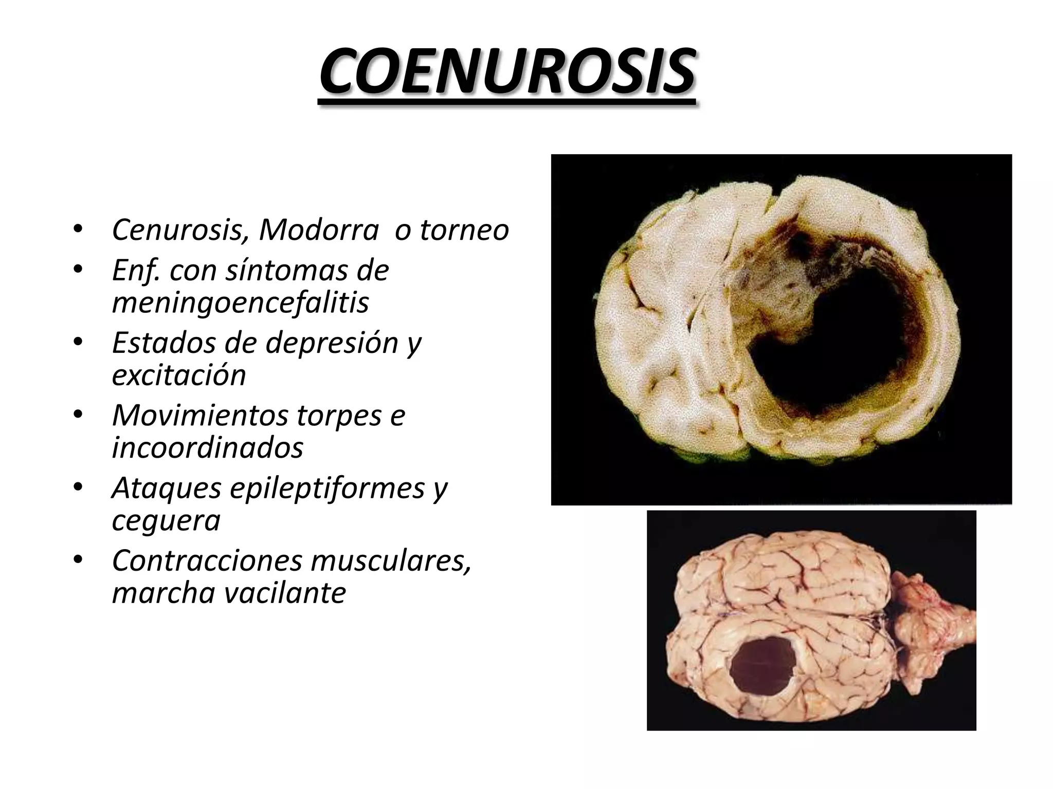  Músculos Intercostales; lengua; pierna (M. Femorales y glúteos).Viabilidad del cisticercos Se destruyen a Temperatura de 49°C.