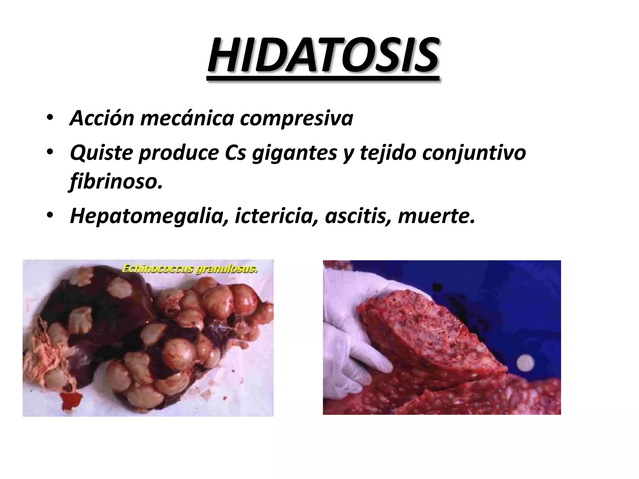 Carnes ahumadas no contienen cisticercos viables.