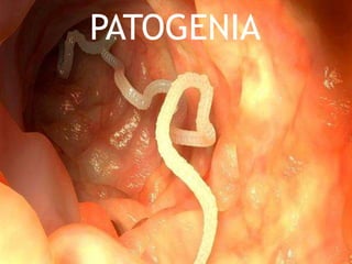 PATOGENIA
 