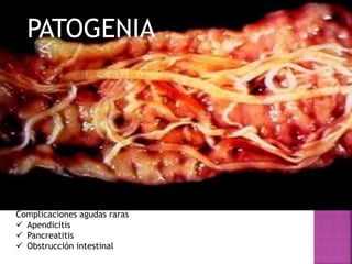 PATOGENIA
Complicaciones agudas raras
 Apendicitis
 Pancreatitis
 Obstrucción intestinal
 