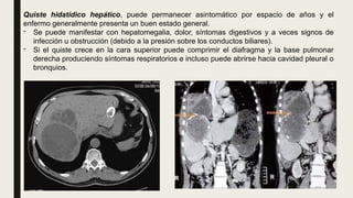 Quiste hidatídico hepático, puede permanecer asintomático por espacio de años y el
enfermo generalmente presenta un buen estado general.
- Se puede manifestar con hepatomegalia, dolor, síntomas digestivos y a veces signos de
infección u obstrucción (debido a la presión sobre los conductos biliares).
- Si el quiste crece en la cara superior puede comprimir el diafragma y la base pulmonar
derecha produciendo síntomas respiratorios e incluso puede abrirse hacia cavidad pleural o
bronquios.
 