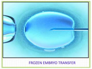 FROZEN EMBRYO TRANSFER
 