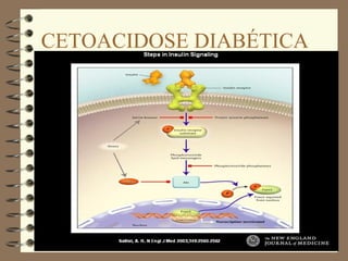 CETOACIDOSE DIABÉTICA
 