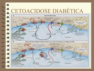 CETOACIDOSE DIABÉTICA
 
