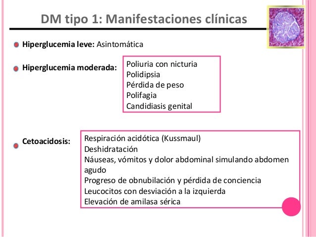 Cetoacidosis diabética en pediatría Cetoacidosis diabética en pediatría