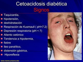 www.reeme.arizona.edu
www.reeme.arizona.edu
Cetoacidosis diabética
Cetoacidosis diabética
Signos
Signos
Taquicardia,
Taquicardia,
hipotensión,
hipotensión,
deshidratación
deshidratación
Respiración de Kusmaull ( pH<7.2)
Respiración de Kusmaull ( pH<7.2)
Depresión respiratoria (pH < 7)
Depresión respiratoria (pH < 7)
Aliento cetónico
Aliento cetónico
Tendencia a hipotermia,
Tendencia a hipotermia,
fiebre
fiebre
Ileo paralítico,
Ileo paralítico,
distensión gástrica,
distensión gástrica,
Hiporeflexia
Hiporeflexia
 
