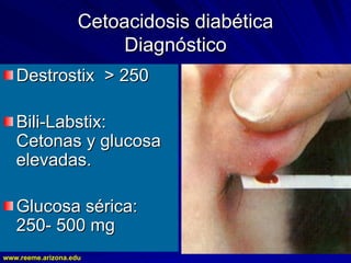 www.reeme.arizona.edu
www.reeme.arizona.edu
Cetoacidosis diabética
Cetoacidosis diabética
Diagnóstico
Diagnóstico
Destrostix > 250
Destrostix > 250
Bili
Bili-
-Labstix:
Labstix:
Cetonas y glucosa
Cetonas y glucosa
elevadas.
elevadas.
Glucosa sérica:
Glucosa sérica:
250
250-
- 500 mg
500 mg
 