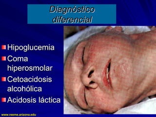 www.reeme.arizona.edu
www.reeme.arizona.edu
Diagnóstico
Diagnóstico
diferencial
diferencial
Hipoglucemia
Hipoglucemia
Coma
Coma
hiperosmolar
hiperosmolar
Cetoacidosis
Cetoacidosis
alcohólica
alcohólica
Acidosis láctica
Acidosis láctica
 