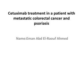 Cetuximab treatment in a patient with
metastatic colorectal cancer and
psoriasis
Name:Eman Abd El-Raouf Ahmed
 