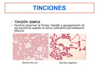 TINCIONES 