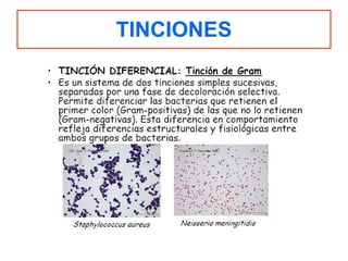 TINCIONES 