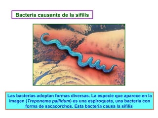 Las bacterias adoptan formas diversas. La especie que aparece en la imagen ( Treponema pallidum ) es una espiroqueta, una bacteria con forma de sacacorchos. Esta bacteria causa la sífilis  Bacteria causante de la sífilis 
