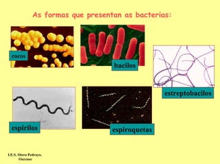 As formas que presentan as bacterias:




  cocos
                                    bacilos


                                                   estreptobacilos



  espirilos                         espiroquetas


I.E.S. Otero Pedrayo.
       Ourense
 