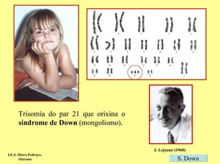 Trisomía do par 21 que orixina o
      síndrome de Down (mongolismo).


                                         J. Lejeune (1960)
I.E.S. Otero Pedrayo.
       Ourense                                       S. Down
 