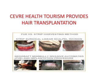 CEVRE HEALTH TOURISM PROVIDES
HAIR TRANSPLANTATION
 