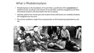 What is Rhabdomyolysis
• Rhabdomyolysis is the breakdown of muscle fibers, specifically of the sarcolemma of
skeletal muscle, resulting in the release of muscle fiber contents (myoglobin) and other
intercellular proteins and electrolytes into the circulation.
• Typically; patient has muscle pain and creatine kinase (CK) levels are markedly elevated,
the myoglubinuria my occur
• The clinical conditions ranges from asymptomatic to life threatening hyperkalemia and
AKI
 