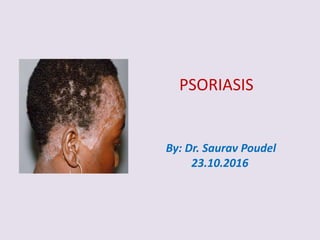 By: Dr. Saurav Poudel
23.10.2016
PSORIASIS
 