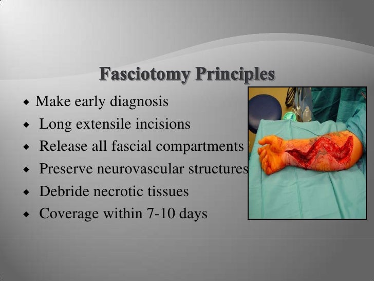 3 A’S Of Pediatric Compartment syndrome