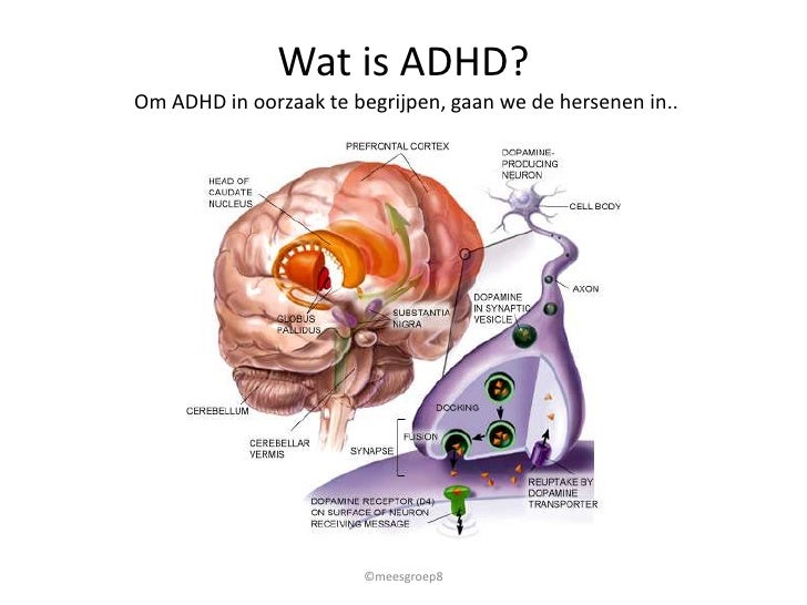 ADHD uitgelegd