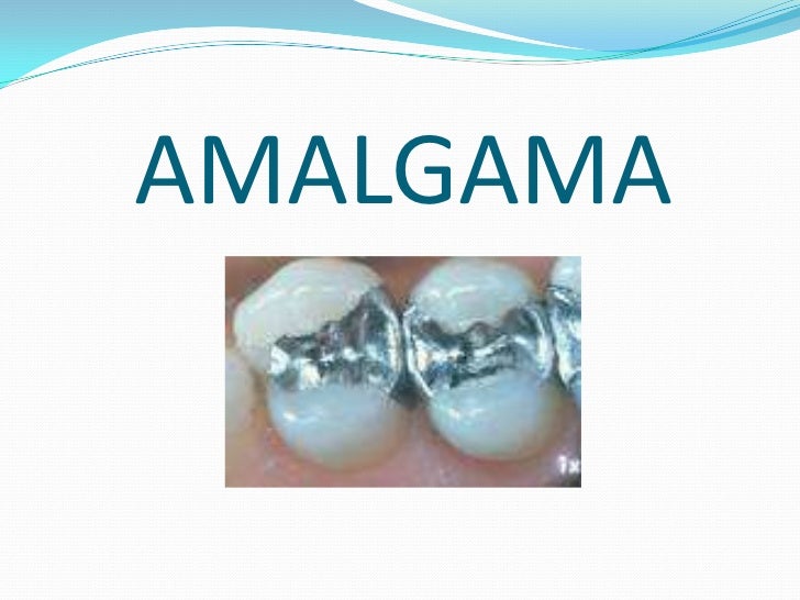 AMALGAMA