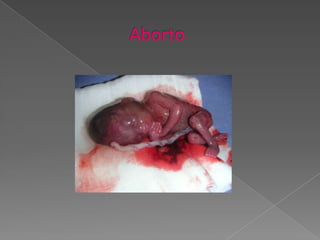                      Aborto 