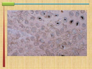 apresentação rework